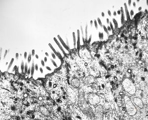 celiakia celiakia